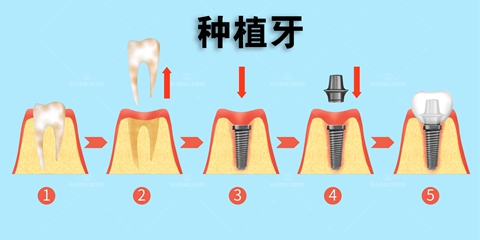 攝圖網(wǎng)